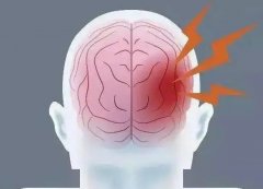 頭痛欲裂感覺要爆炸了怎么辦？